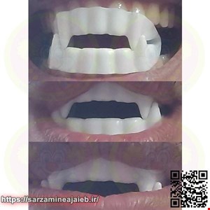 ابزار شوخی دنیای سرگرمی های کمیاب طرح دندان مصنوعی مدل DSK1810 